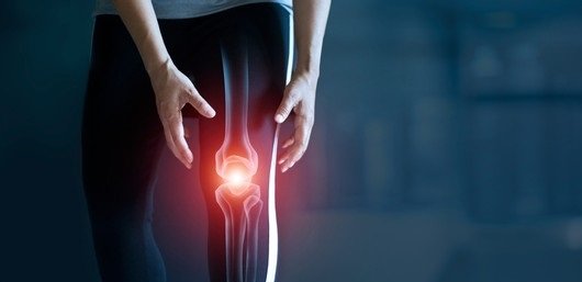 Knee Osteoarthritis