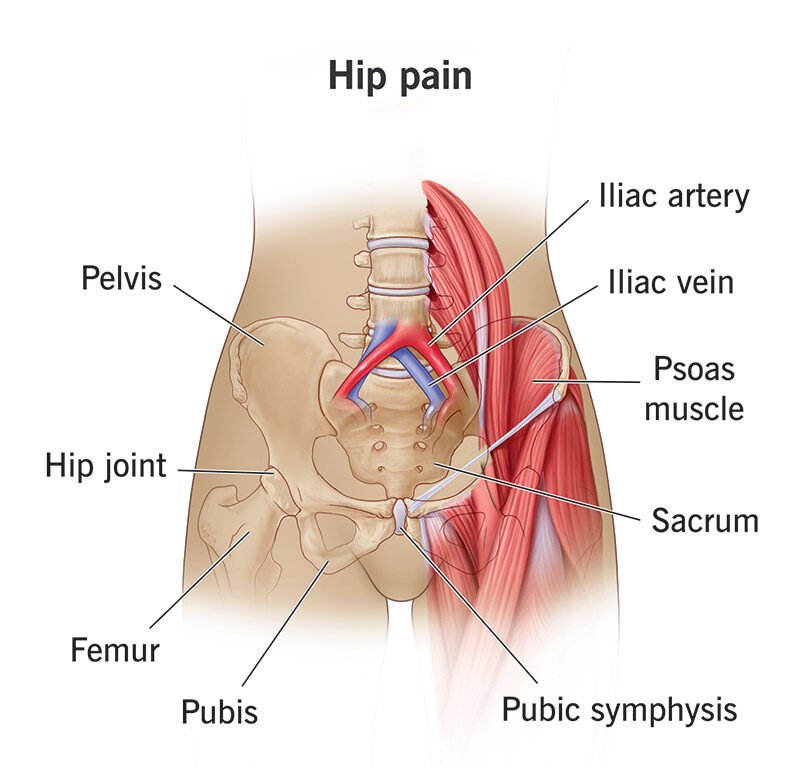 Hip Pain Treatment in Delhi