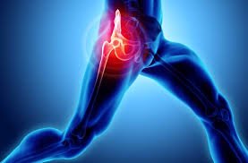 Best Hip Pain Specialist in Rohini