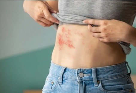 Best Scar Neuralgia Treatment Clinic in Delhi