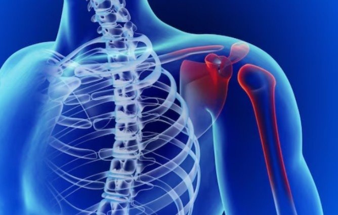 Frozen Shoulder Pain Management in Delhi